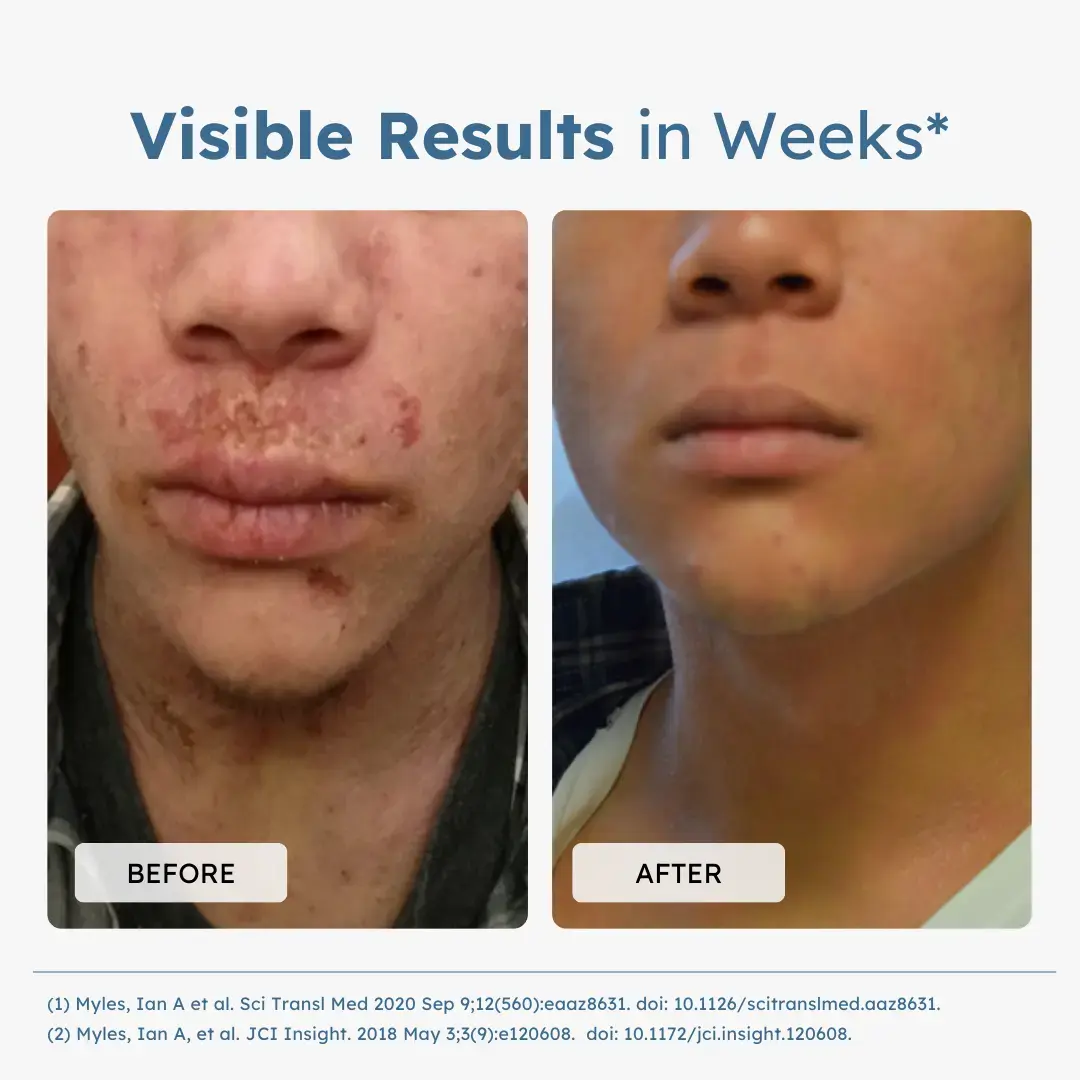 Defensin+™ Probiotic Spray - Image 4